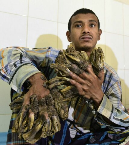 Otras nociones de causas