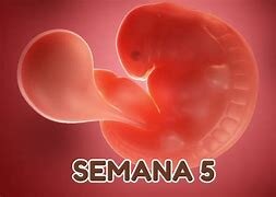 Semana 5