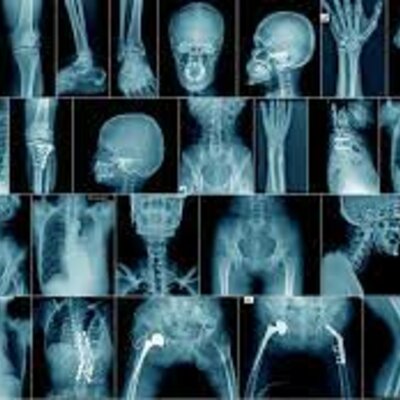 Timeline: Proteccion Radiologica