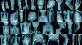 Timeline: Proteccion Radiologica