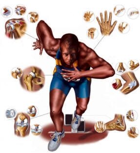 Causas de las lesiones deportivas.