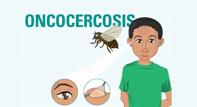 Lanzamiento del programa de lucha contra la oncocercosis