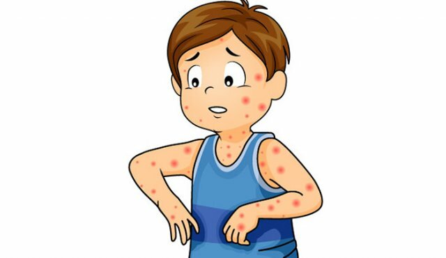 Lanzamiento de la iniciativa de lucha contra el sarampión