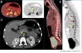 INICIO DE MEDIOS DE CONTRASTE PET-TAC