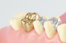 GIOVANNI D,ARCOLI - 1848 a.C.