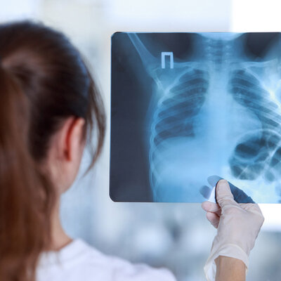 Timeline: Técnicas de imágenes diagnósticas