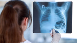 Timeline: Técnicas de imágenes diagnósticas