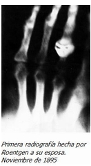 Descubrimiento de los rayos X