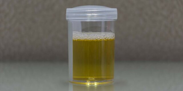 Causa de la infección urinaria