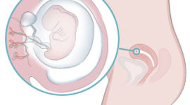Timeline: Semanas de Gestación.