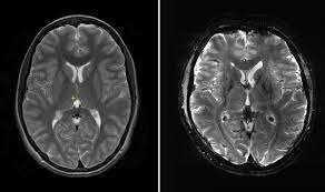 Equipo de tomografía computarizada.