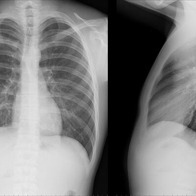 Timeline: Radiología convencional