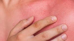 APLICACIONES DESDE 1895 HASTA NUESTROS DÍAS DE LA RADIACIÓN IONIZANTE 1933