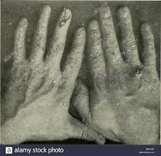 EFECTOS BIOLÓGICOS DE LA RADIACIÓN 1901