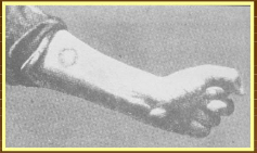 EFECTOS BIOLÓGICOS DE LA RADIACIÓN 1901