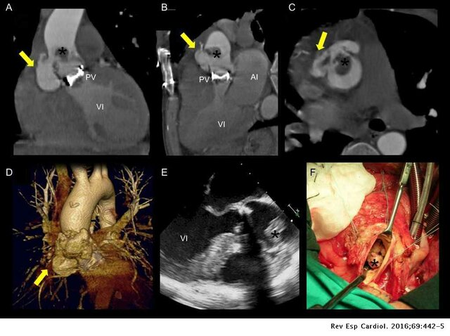 Tomografía Computada multidetector