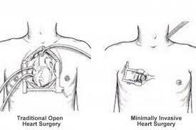 20th century continued