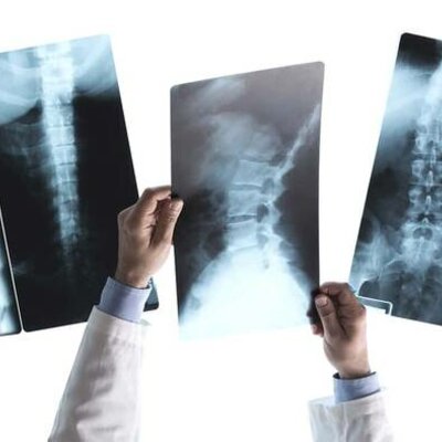 Timeline: Radiología convencional