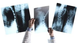 Timeline: Radiología convencional