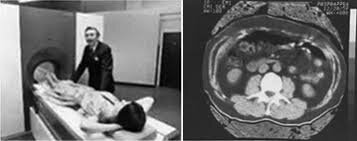 Aparición TAC 2da generación