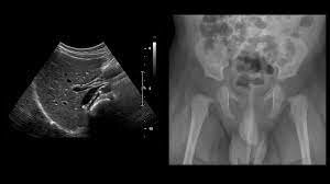 Evento 3 Aplicaciones desde 1895 hasta nuestros días de la radiación ionizante