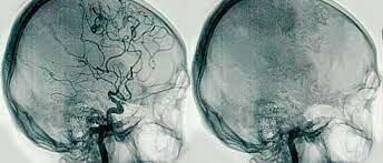Evento 4 Aplicaciones desde 1895 hasta nuestros días de la radiación ionizante