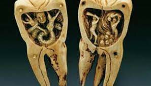 ENFERMEDADES DENTALES - 1550 a.c.