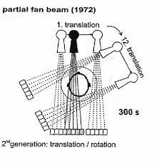 TOMOGRAFO PRIMERA GENERACION
