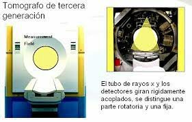 TOMOGRAFO TERCERA GENERACION