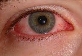 Comité internacional de protección radiológica