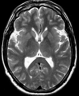PUBLICACION PRIMERA RESONANCIA MAGNETICA