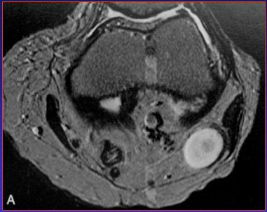AVANCES DE LA RESONANCIA MAGNETICA