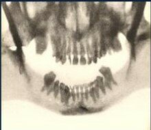 RADIOGRAFIA DENTAL