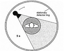 Tomógrafo de cuarta generación el cual cuenta con haz en forma de abanico de proyección completa y anillos de detectores completos estáticos, cada corte durada 5 segundos.