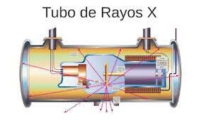QUE ES UN TUBO DE RAYOS X