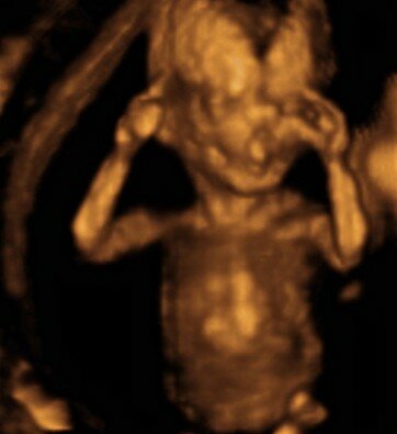 Su piel es delgada  y está formado (Semana12)