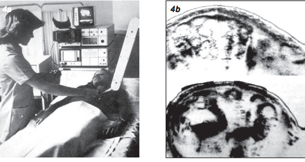 Se creó el ultrasonido.
