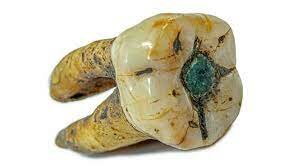 Mayas: Prótesis con jade