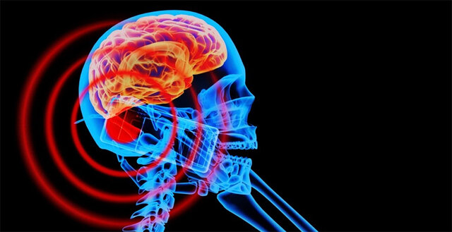 EFECTOS RADIOLOGICOS DE LA RADIACION