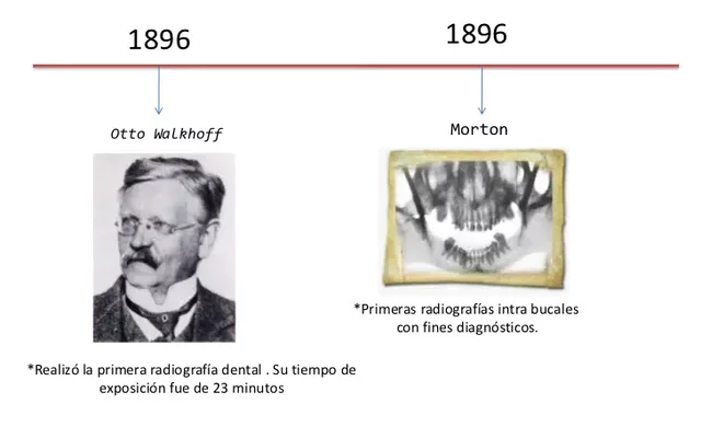 RADIOGRAFIA DE MAXILARES