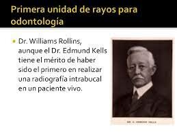 RADIOGRAFIA INTRABUCAL