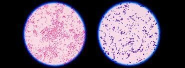 Desarrollan la tinción de Gram para bacterias y la de Ziehl-Nielsen para Micobacterium tuberculosis.