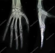 La primera imagen documentada en los Estados Unidos