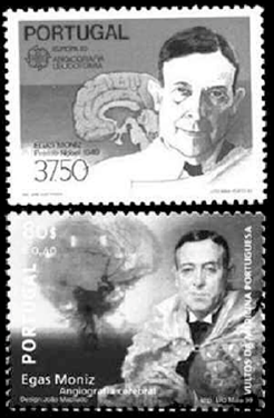 Angiografía con catéter (contraste)