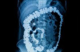 Aplicaciones desde 1895 hasta nuestros días de la radiación ionizante