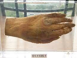 Efectos biológicos de la radiación