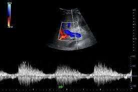 4.Aplicaciones desde 1895 hasta nuestros días de la radiación ionizante