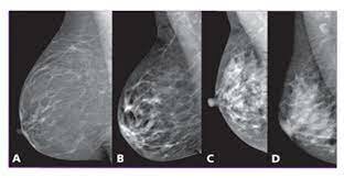 2.Aplicaciones desde 1895 hasta nuestros días de la radiación ionizante