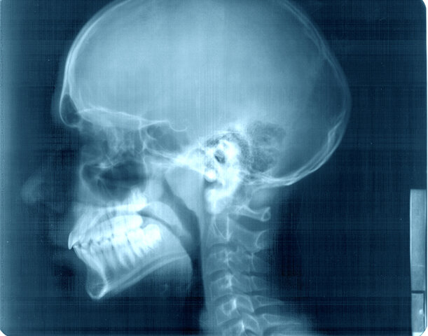 COMITÉ INTERNACIONAL DE PROTECCIÓN RADIOLÓGICA