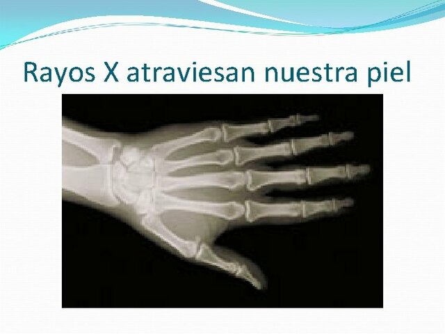 MAGNITUDES, UNIDADES, LIMITACIÓN DE RADIACIÓN